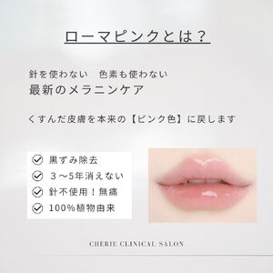 ローマ②-2